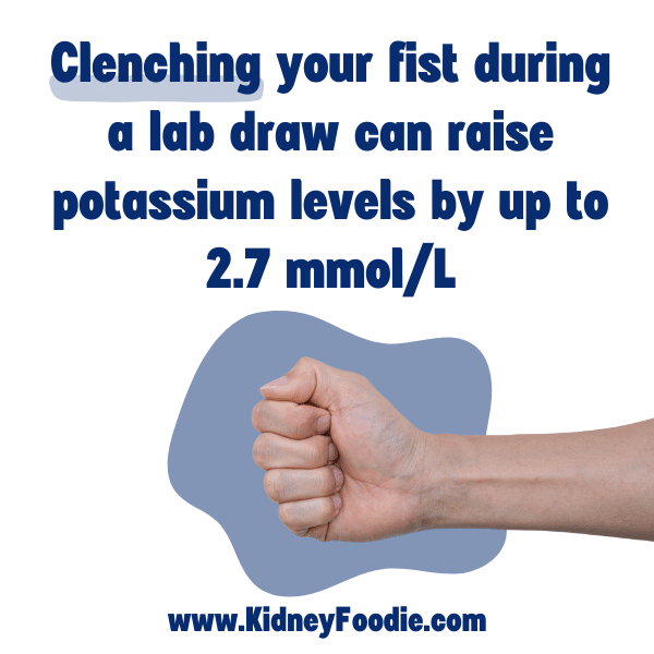 Fist clenching raises potassium levels in CKD